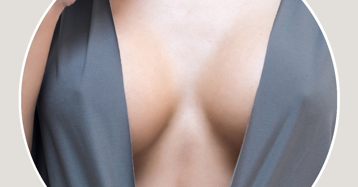 Mamoplastia de aumento
