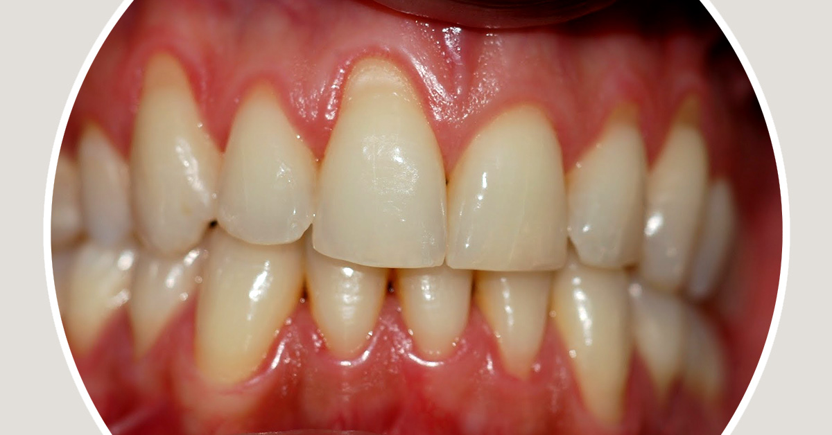 Periodontologia
